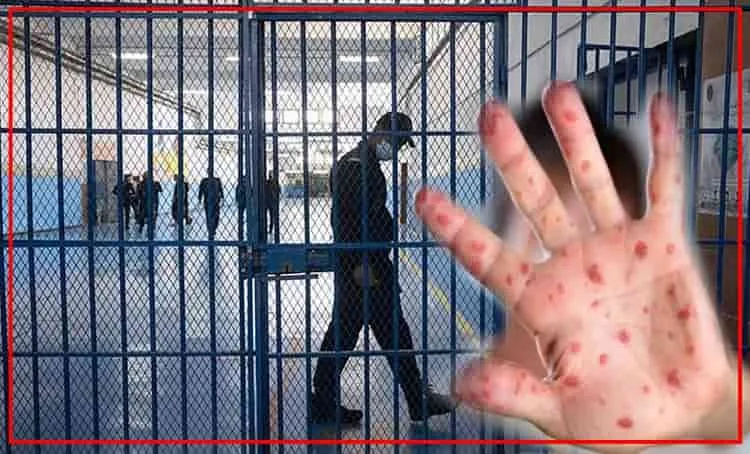 قلق مجتمعي من انتشار الحصبة ووزارة الصحة تطلق حملة التلقيح في الزمن الضائع